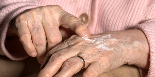 Prevention and Management Tips for Crepey Skin