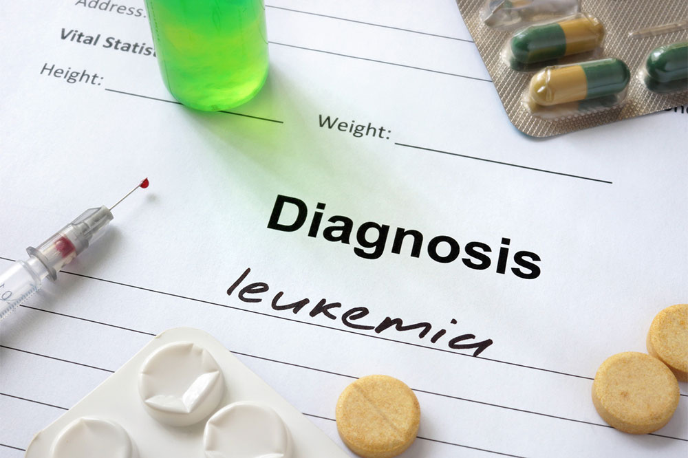 Acute Myeloid Leukemia – Stages, Types, Symptoms, Causes, and Therapies