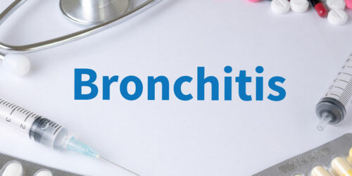Bronchitis – Top Remedies and Management Options