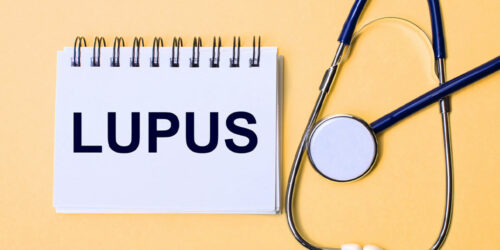 Lupus – Signs, Causes and Types