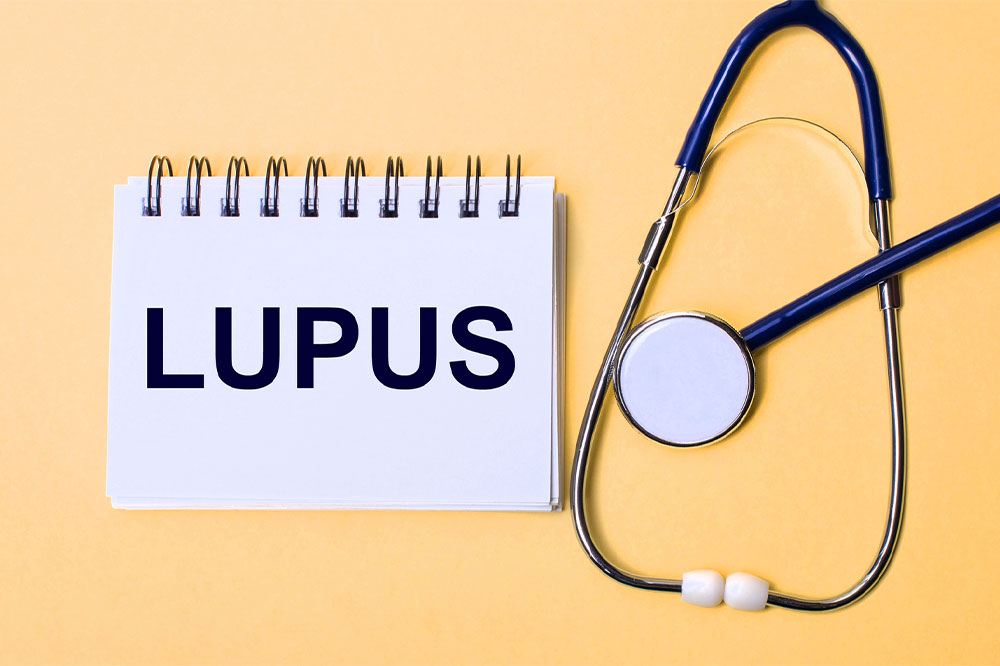 Lupus – Signs, Causes and Types