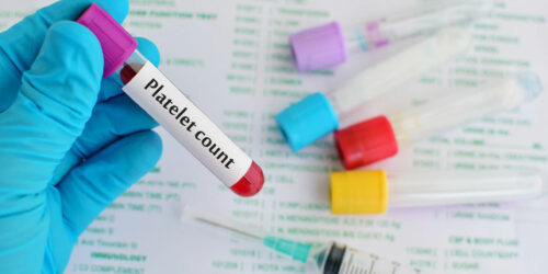 Low Platelet Count – Ways to Manage the Condition