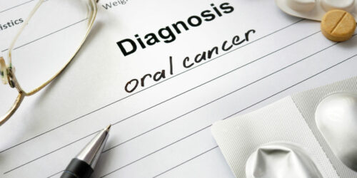 Oral Cancer – Symptoms, Causes and Management Options