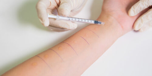 Here’s how you can get your allergies detected