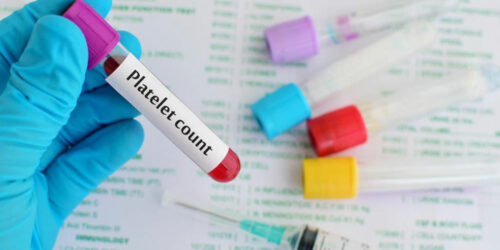 Low platelets count – Its causes and symptoms