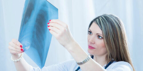 Pneumonia – Causes, signs and treatments