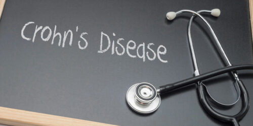 Symptoms, Types, and More About Crohn’s Disease