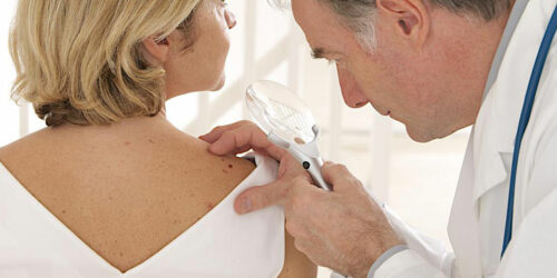 4 common treatment options for myeloma-affected patients