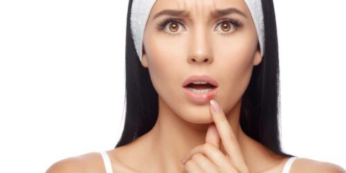 5 Common STDs to Watch Out For