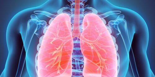 Everything you should know about lung cancer
