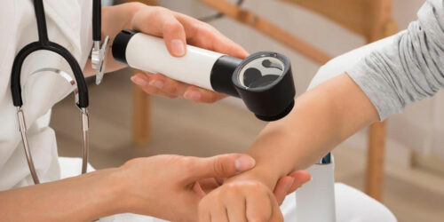 Eczema – Symptoms, Complications, and Treatment Options