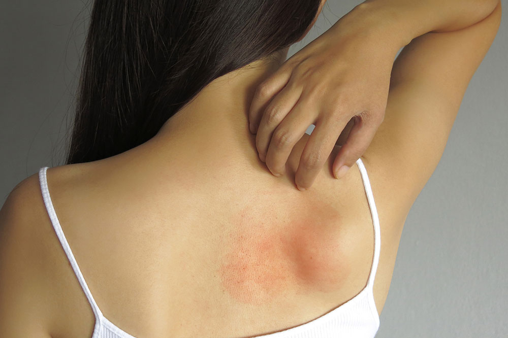 Here’s what you should know about allergies and how to treat them