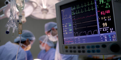 Know Your Heart Rate – When Should You Worry