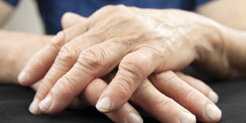 Rheumatoid Arthritis – Diagnosis and Treatment Options