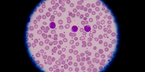 Types of blood disorders you must know about