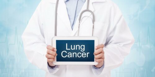 Treatments for Lung Cancer
