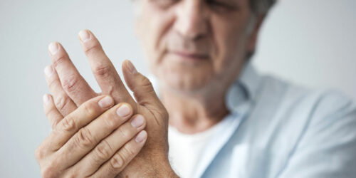 What you did not know about arthritis