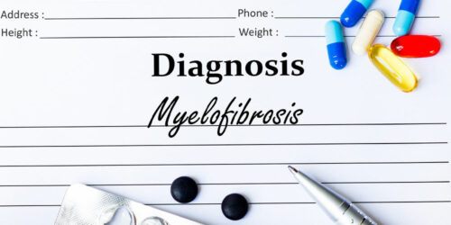 Myelofibrosis – Symptoms, causes, and management options