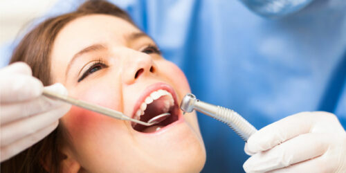 Here’s Everything to Know About Dental Bridging